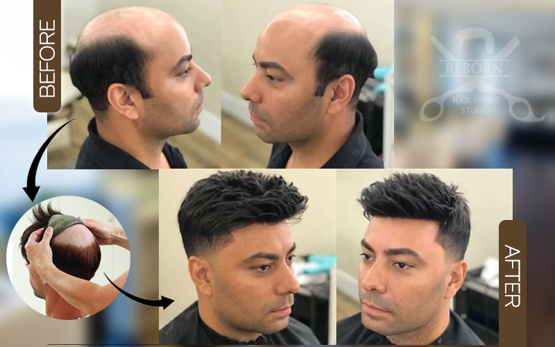 Hair Bonding Procedure – Reborn Hair Fixing Studio