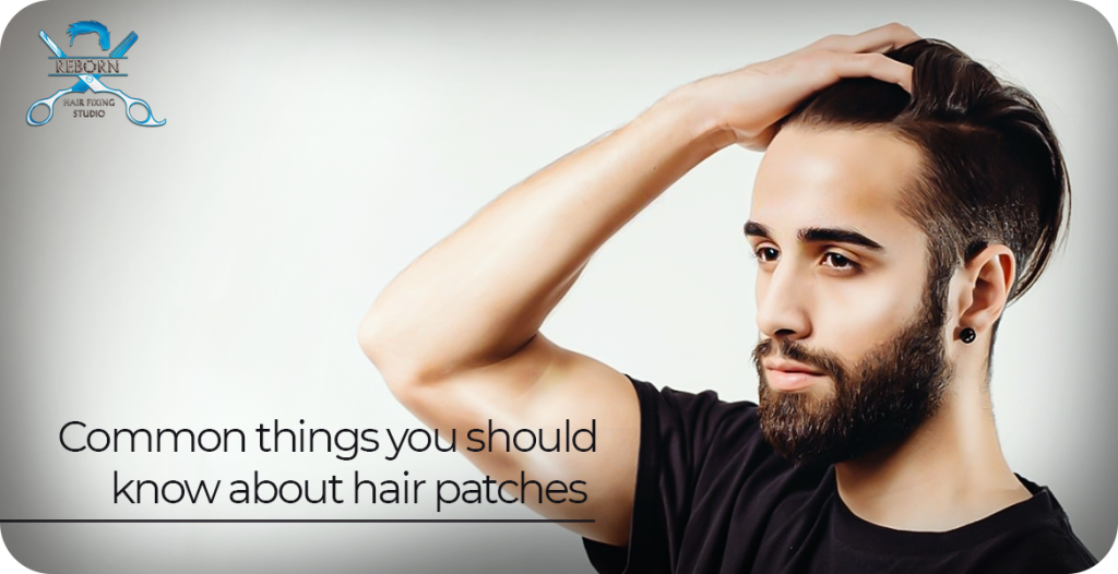 common things about hair patches