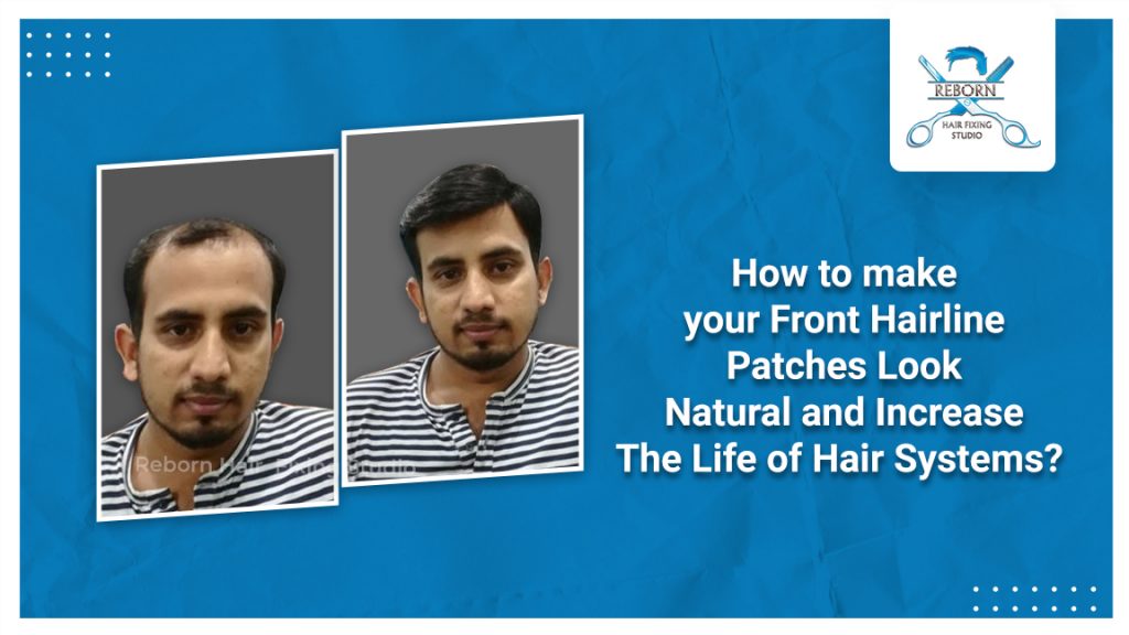 front hairline patches look natural and increase the life of hair systems
