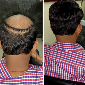 Hair weave service in hyderabad