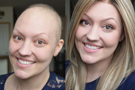 Chemo wigs for Women